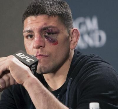 Nick Diaz