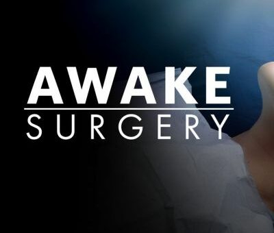 Awake Surgery