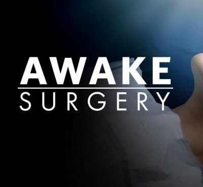 Awake Surgery