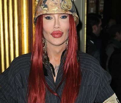 Pete Burns